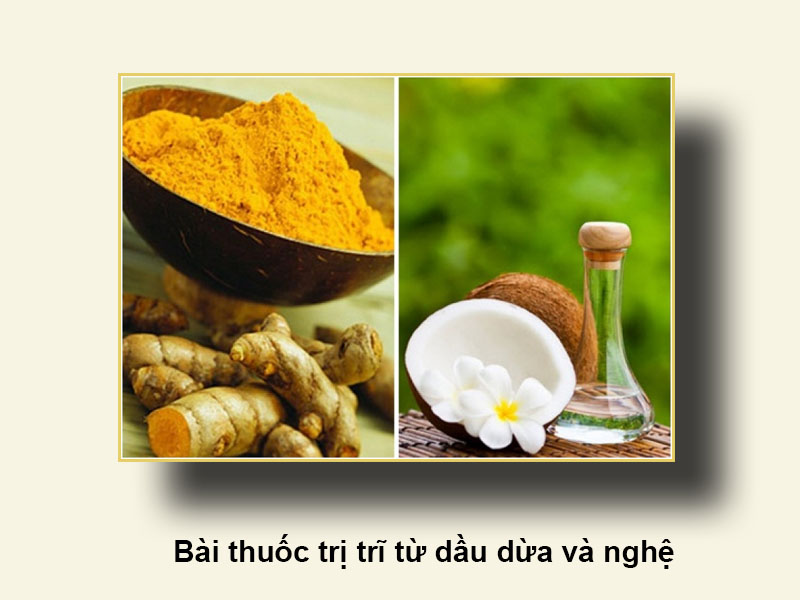 Bài thuốc trị trĩ từ dầu dừa và nghệ