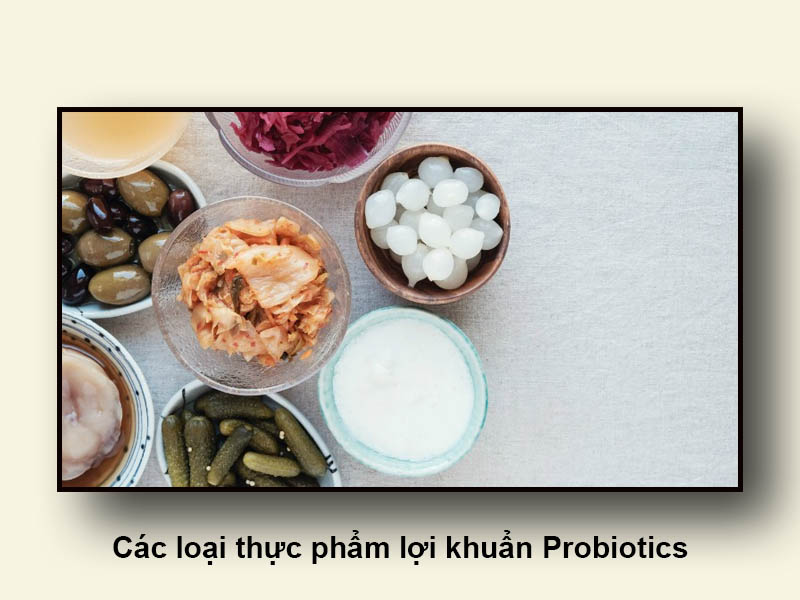 Các loại thực phẩm lợi khuẩn Probiotics