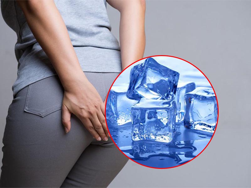 Chườm lạnh làm dịu cơn đau trĩ