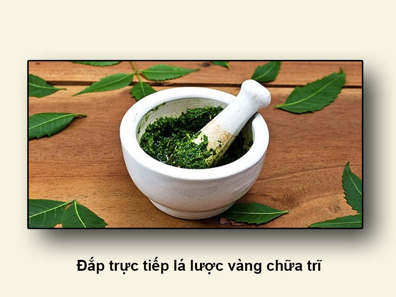 Đắp trực tiếp lá lược vàng chữa trĩ