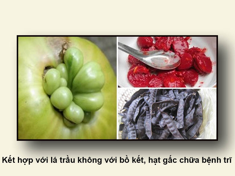 Kết hợp với lá trầu không với bồ kết, hạt gấc chữa bệnh trĩ