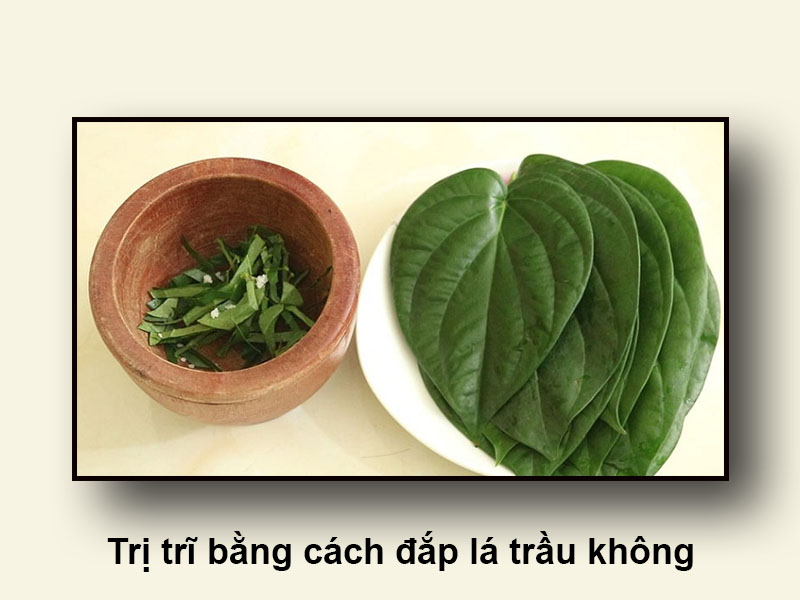 Trị trĩ bằng cách đắp lá trầu không