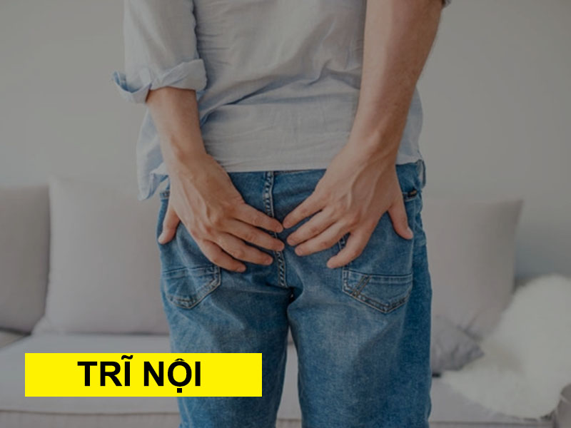 Trĩ nội