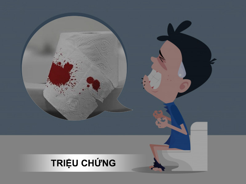 Triệu chứng của trĩ nội