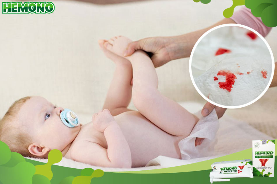 Nguyên nhân khiến bé đi ngoài ra máu là gì?