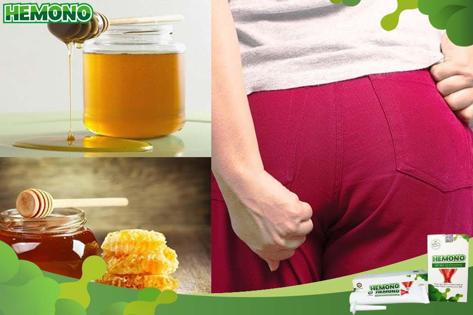 Dùng mật ong chữa bệnh trĩ