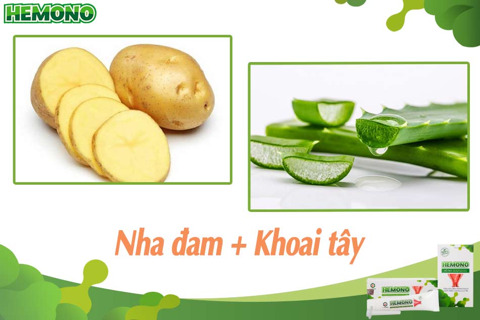 Chữa trĩ bằng lá nha đam và khoai tây