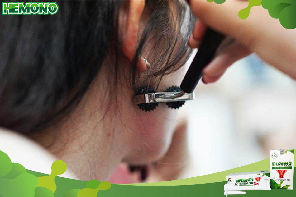 Chữa bệnh trĩ bằng diện chẩnn