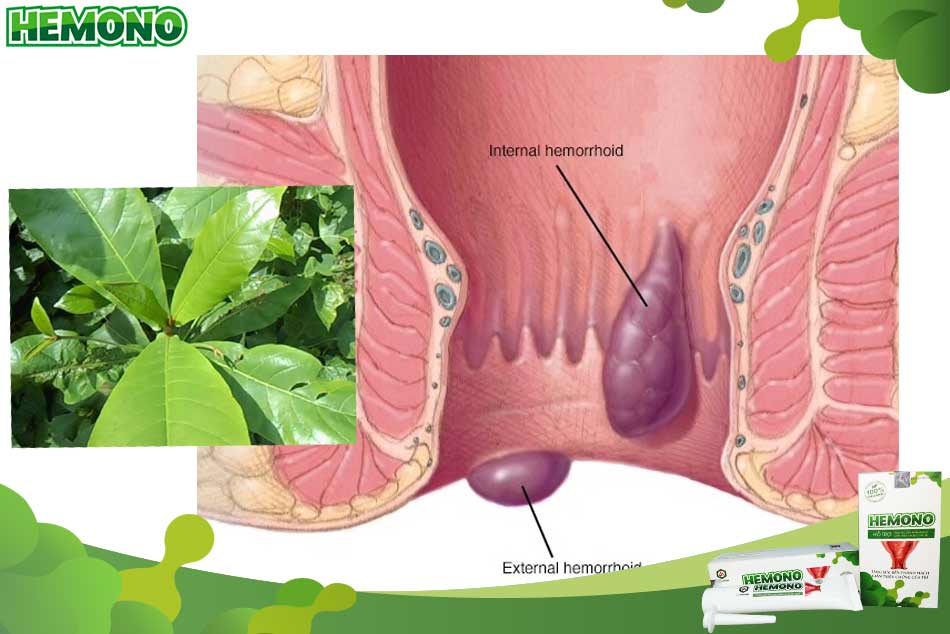 Những điểm cần lưu ý khi sử dụng lá bàng chữa bệnh trĩ