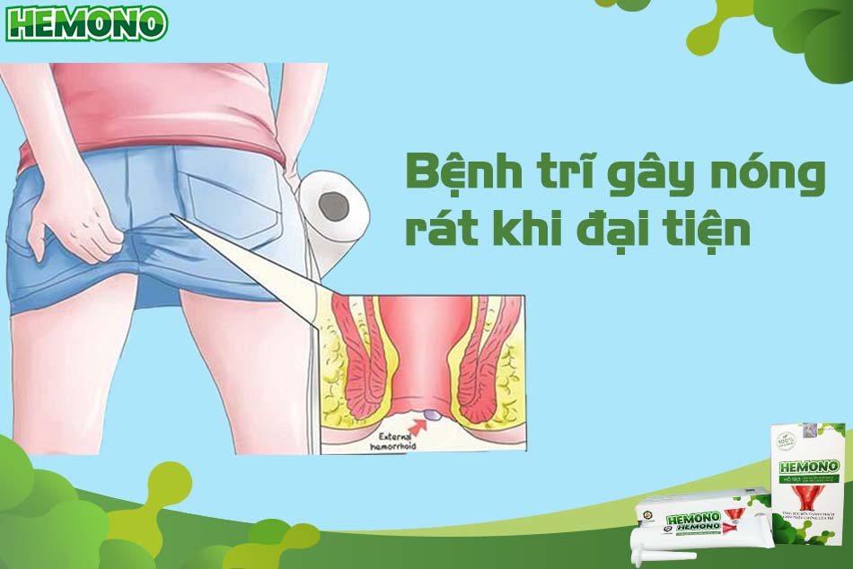 Bệnh trĩ cũng là một nguyên nhân gây rát hậu môn