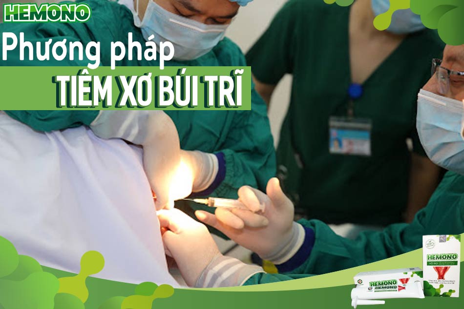 Những điều cần biết về phương pháp tiêm xơ búi trĩ