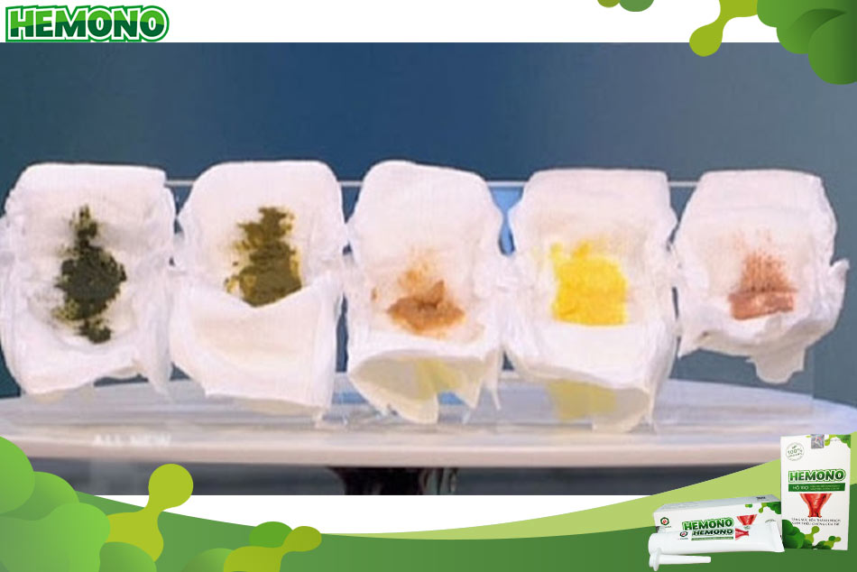 Tình trạng phân khi trẻ đi ngoài phân sống