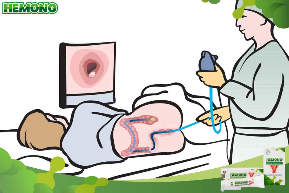 Cần lưu ý gì khi nội soi trực tràng?
