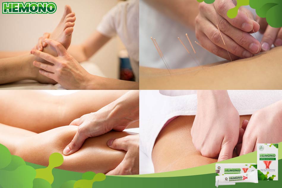 Cách chữa bệnh trĩ bằng châm cứu, bấm huyệt