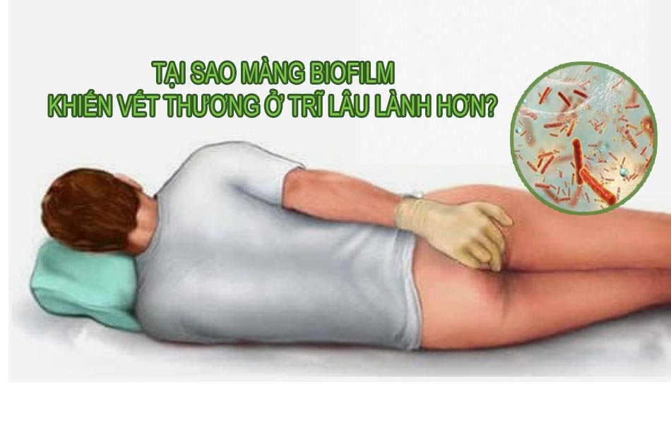 Tại sao màng Biofilm khiến vết thương ở trĩ lâu lành hơn?