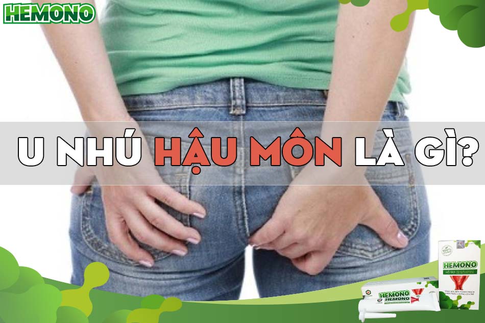U nhú hậu môn là gì?