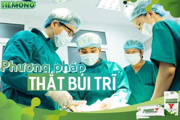 Phương pháp thắt búi trĩ là gì?