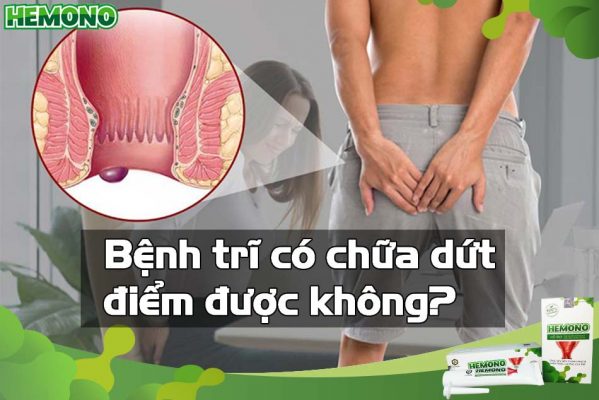 Bệnh trĩ có chữa dứt điểm được không?