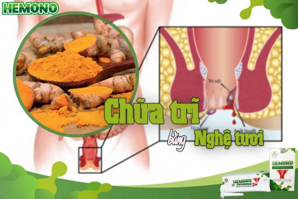 Tác dụng của nghệ tươi trong việc chữa trĩ