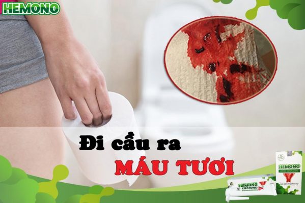 Đi cầu ra máu tươi là bệnh gì?
