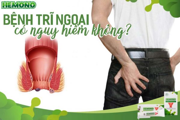 Bệnh trĩ ngoại có nguy hiểm không, cách điều trị như thế nào?