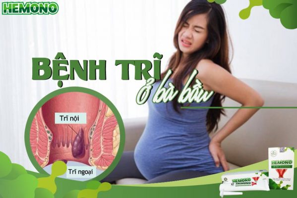 Bệnh trĩ ở bà bầu là gì?